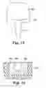 Fig. 09 - Method of manufacturing a hardenable dental article