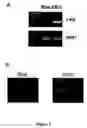 Fig. 02 - Gene expression profile for KSHV infection and methods for treating same