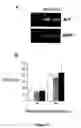 Fig. 04 - Gene expression profile for KSHV infection and methods for treating same