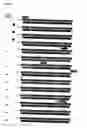 Fig. 02 - Compositions and methods for genetic analysis of polycystic kidney disease