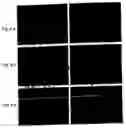 Fig. 05 - Method and medicament for inhibiting the expression of a given gene