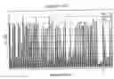 Fig. 07 - Chronic lymphocytic leukemia cell line