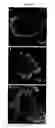 Fig. 08 - 5T4 antigen expression