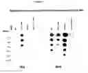 Fig. 03 - Detection of prion disease