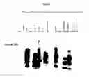 Fig. 04 - Detection of prion disease