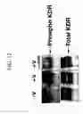 Fig. 14 - KDR and VEGF/KDR binding peptides and their use in diagnosis and therapy