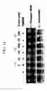Fig. 18 - KDR and VEGF/KDR binding peptides and their use in diagnosis and therapy