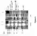 Fig. 05 - Diagnostic methods for congestive heart failure
