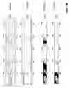 Fig. 02 - Detection of endometrial pathology