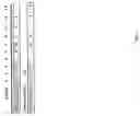 Fig. 04 - Compositions and methods for early pregnancy diagnosis
