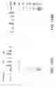 Fig. 414 - Factor IX: remolding and glycoconjugation of Factor IX