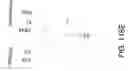 Fig. 416 - Factor IX: remolding and glycoconjugation of Factor IX