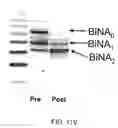 Fig. 417 - Factor IX: remolding and glycoconjugation of Factor IX