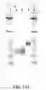 Fig. 456 - Factor IX: remolding and glycoconjugation of Factor IX