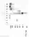 Fig. 458 - Factor IX: remolding and glycoconjugation of Factor IX