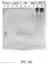 Fig. 470 - Factor IX: remolding and glycoconjugation of Factor IX