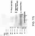 Fig. 479 - Factor IX: remolding and glycoconjugation of Factor IX