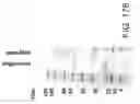 Fig. 480 - Factor IX: remolding and glycoconjugation of Factor IX