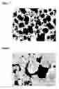 Fig. 02 - Oligodendrocytes derived from human embryonic stem cells for remyelination and treatment of spinal cord injury
