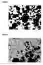 Fig. 03 - Oligodendrocytes derived from human embryonic stem cells for remyelination and treatment of spinal cord injury
