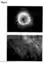 Fig. 05 - Oligodendrocytes derived from human embryonic stem cells for remyelination and treatment of spinal cord injury