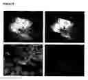 Fig. 16 - Oligodendrocytes derived from human embryonic stem cells for remyelination and treatment of spinal cord injury