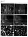 Fig. 17 - Oligodendrocytes derived from human embryonic stem cells for remyelination and treatment of spinal cord injury