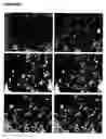 Fig. 18 - Oligodendrocytes derived from human embryonic stem cells for remyelination and treatment of spinal cord injury