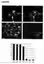 Fig. 19 - Oligodendrocytes derived from human embryonic stem cells for remyelination and treatment of spinal cord injury