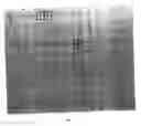 Fig. 03 - Allergen-microarray assay