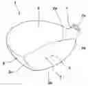 Fig. 01 - Golf club head