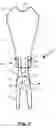 Fig. 03 - Divot repair tool for golfers