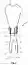 Fig. 04 - Divot repair tool for golfers