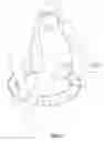 Fig. 06 - Resisting-slippery pad for exercise ball
