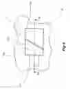 Fig. 06 - Opening arrangement, packaging and method of providing a packaging with an opening arrangement