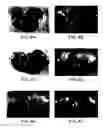 Fig. 06 - Modulation of angiogenesis
