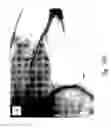 Fig. 11 - Compositions and methods for treating or preventing diseases of body passageways