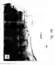 Fig. 12 - Compositions and methods for treating or preventing diseases of body passageways