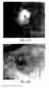 Fig. 66 - Compositions and methods for treating or preventing diseases of body passageways