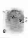 Fig. 77 - Compositions and methods for treating or preventing diseases of body passageways