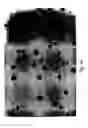 Fig. 79 - Compositions and methods for treating or preventing diseases of body passageways