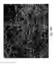 Fig. 86 - Compositions and methods for treating or preventing diseases of body passageways