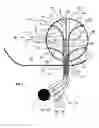 Fig. 04 - Device for radiation treatment of proliferative tissue surrounding a cavity in an animal body