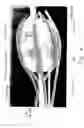 Fig. 05 - Device for radiation treatment of proliferative tissue surrounding a cavity in an animal body