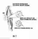 Fig. 02 - Magnetic therapy clothing articles and complex magnetic unit for use therewith