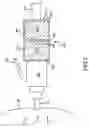 Fig. 06 - Implantable hearing aid transducer interface