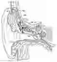 Fig. 01 - Microphone optimized for implant use