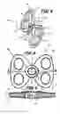 Fig. 04 - Penile tension system, device, kit, and methods of using same