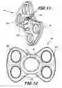 Fig. 07 - Penile tension system, device, kit, and methods of using same
