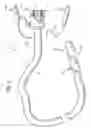 Fig. 02 - Methods and devices for diagnostic and therapeutic interventions in the peritoneal cavity